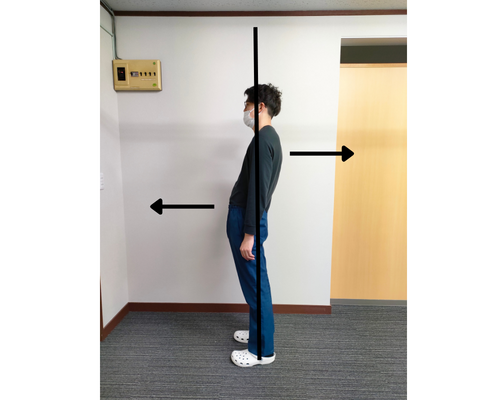スウェイバックは前彎と同じですか?